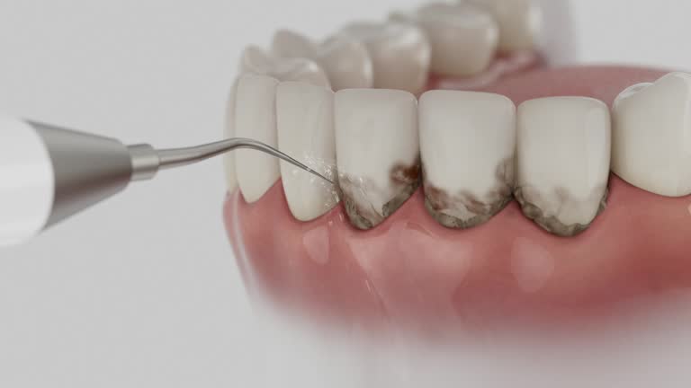 Trusted Dental Implants service in Ionia, MI - Dentist Open Now